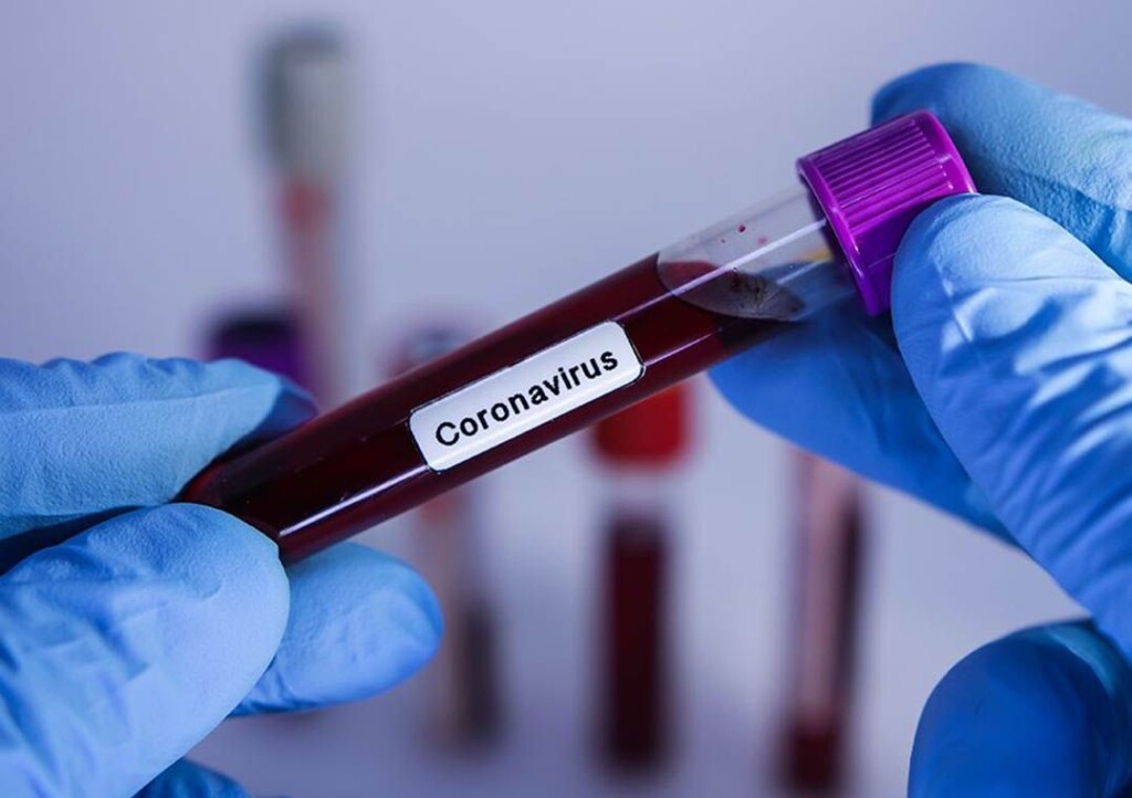 É Fake! Cuba não criou vacina contra o coronavírus | É Fake ...